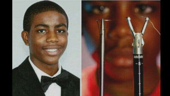 At only age 14, Tony Hansberry II invented a surgical stitching device