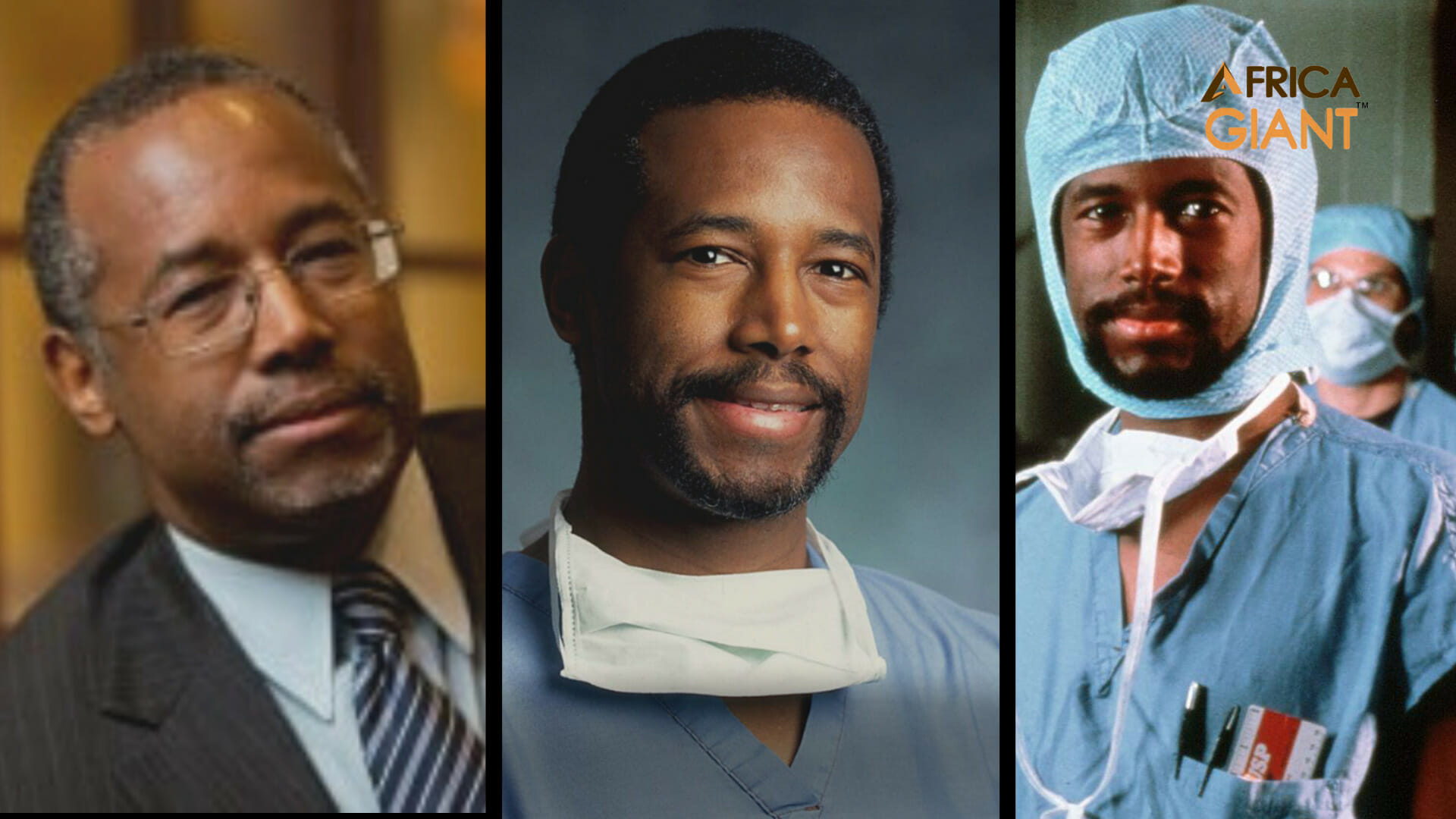 Benjamin Carson first doctor on earth to separate a conjoined twins at the head